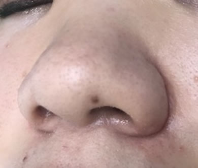 最後に水分たっぷりのジェルをつけならがお肌を引き締めます